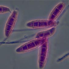 Microsporum ferrugineum